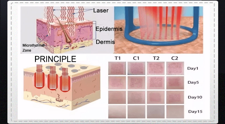 点阵激光详情页改小_04