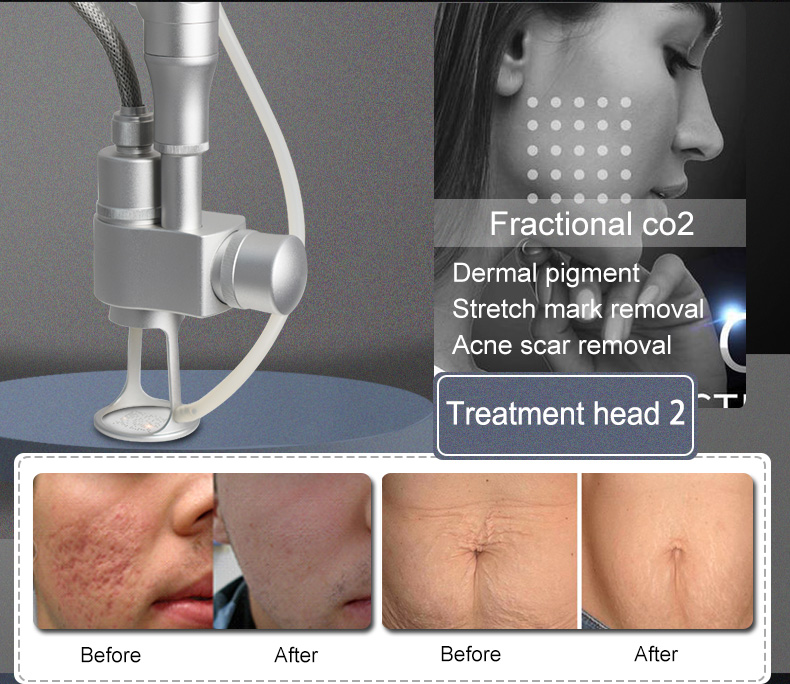 点阵激光详情页改小_07