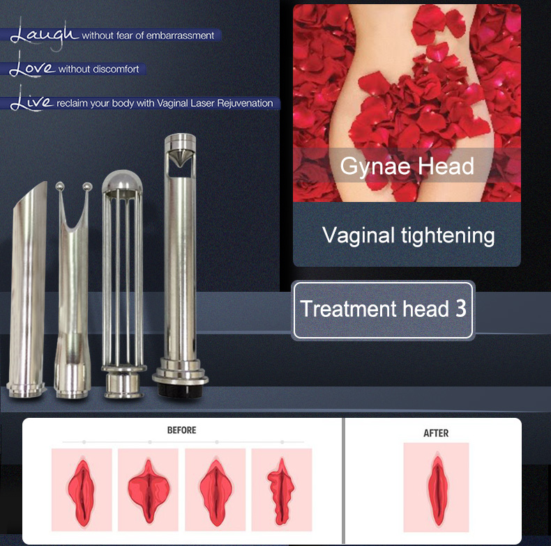 点阵激光详情页改小_08